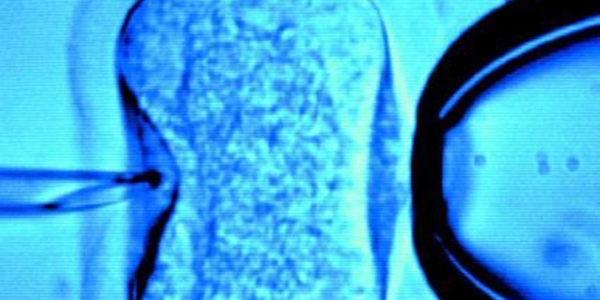 umjetna oplodnja – in vitro umjetna oplodnja – in vitro