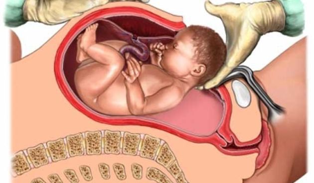 Carski rez, foto: www.oslobodjenje.ba