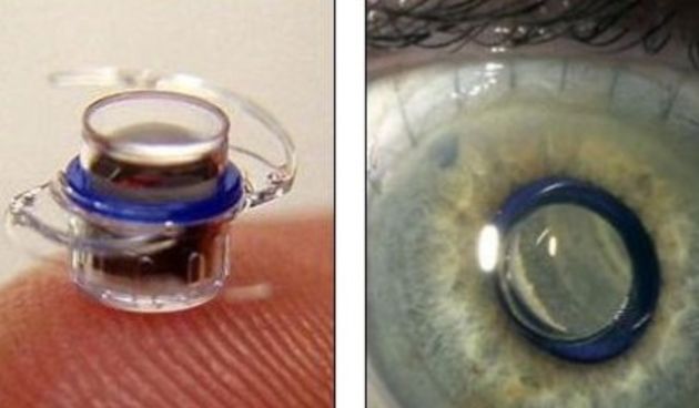 Umjesto naočala koristit ćemo očne teleskope? (Metro-portal.hr )