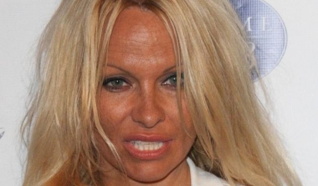 Otkrivena tajna staračkog izgleda Pamele Anderson (Index.hr)