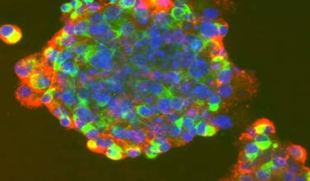 Matične stanice (Foto: HTV)