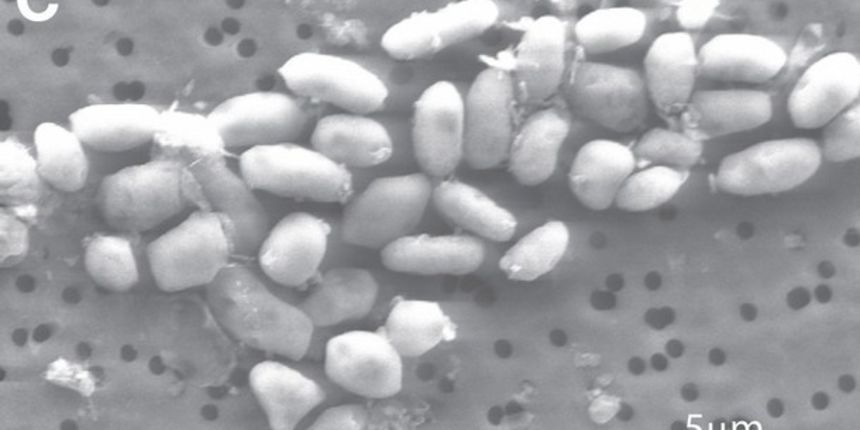 Bakterija GFAJ-1 A , Foto: Reuters Bakterija GFAJ-1 A , Foto: Reuters