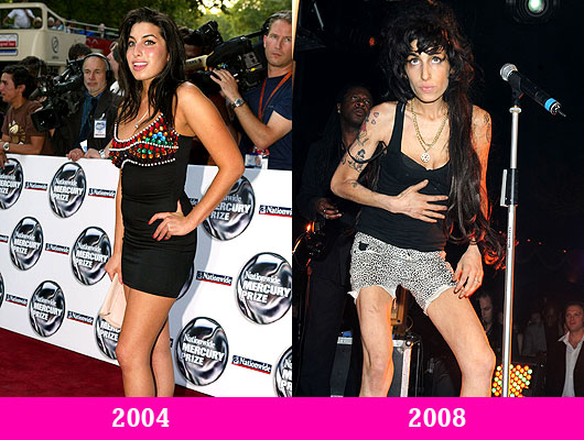 Nezdravo mršave celebrity dame