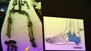 Otkrivene tajne relikvija zadarskih zaštitnika Otkrivene tajne relikvija zadarskih zaštitnika