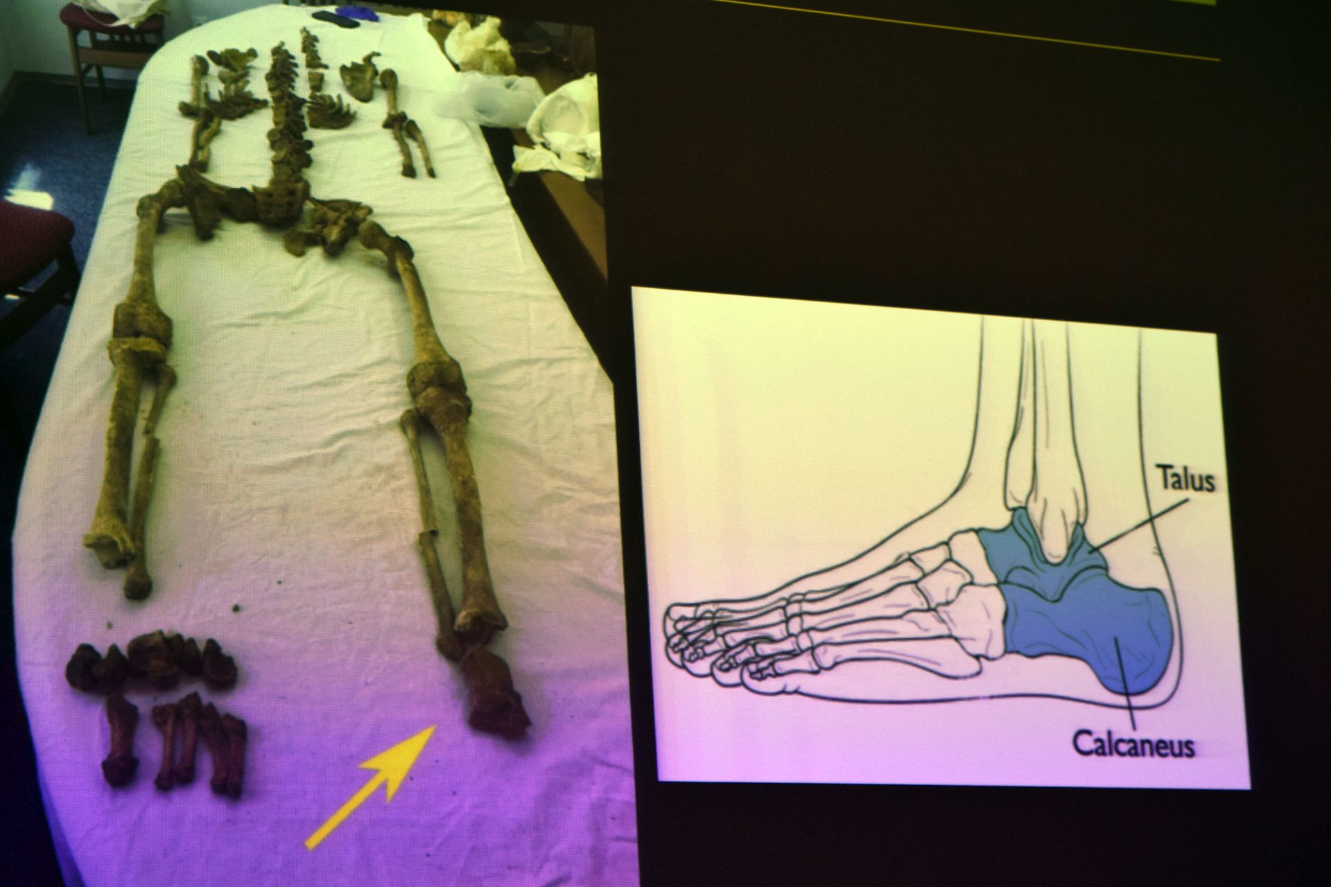 Otkrivene tajne relikvija zadarskih zaštitnika Otkrivene tajne relikvija zadarskih zaštitnika