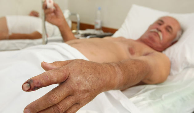 Drago Relja u bolnici (Foto: Vladimir Ivanov / CROPIX )