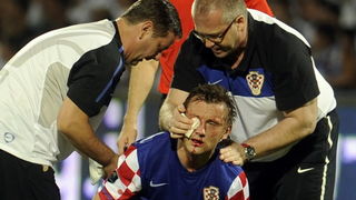 Tel Aviv, 091010. Ramat-Gan Stadion. Kvalifikacijska nogometna utakmica grupe F izmedju Izraela i Hrvatske za Euro 2012 u Poljskoj i Ukrajini. Na slici: Ivica Olic sa razbijenim nosom, pored njega se nalaze doktor Bahtijarevic i fizioterapeut Sisgoreo a u