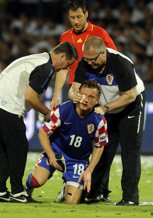 Tel Aviv, 091010. Ramat-Gan Stadion. Kvalifikacijska nogometna utakmica grupe F izmedju Izraela i Hrvatske za Euro 2012 u Poljskoj i Ukrajini. Na slici: Ivica Olic sa razbijenim nosom, pored njega se nalaze doktor Bahtijarevic i fizioterapeut Sisgoreo a u
