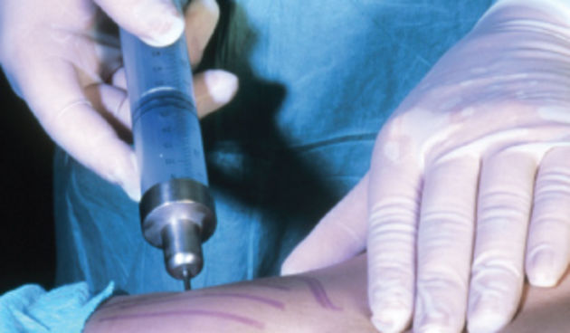 Moderna liposukcija, foto: surgeries.justsickshit.com