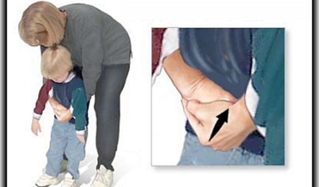 Gušenje, dijete, pomoć, foto: žena.hr