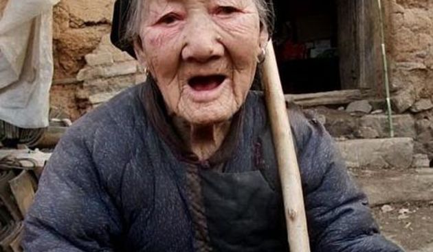 Kineskinji izrastao misteriozni rog nasred čela (Metro-portal.hr)