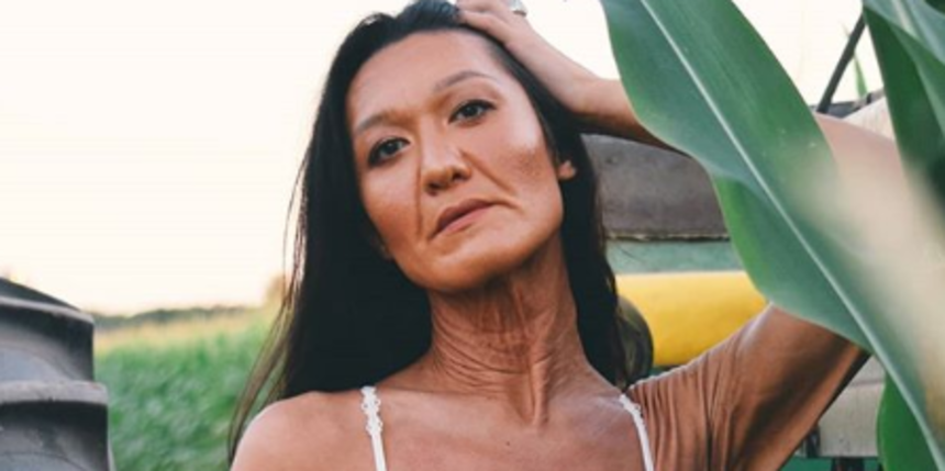 Zbog rijetke bolesti Sara ima kožu starice, ali naučila ju je voljeti