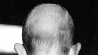 Braća Brkan: Slike sna i svjetlosti Braća Brkan: Slike sna i svjetlosti