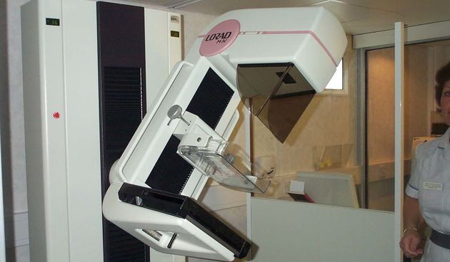 Mamograf (Foto: northumberlandcaretrust.nhs.uk)
