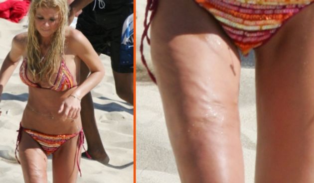 Tara Reid, žrtva plstičnih operacija (Index.hr)