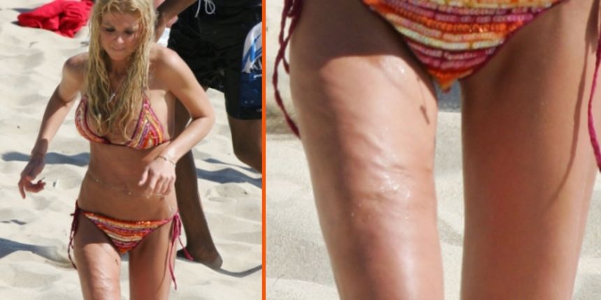 Tara Reid, žrtva plstičnih operacija (Index.hr)