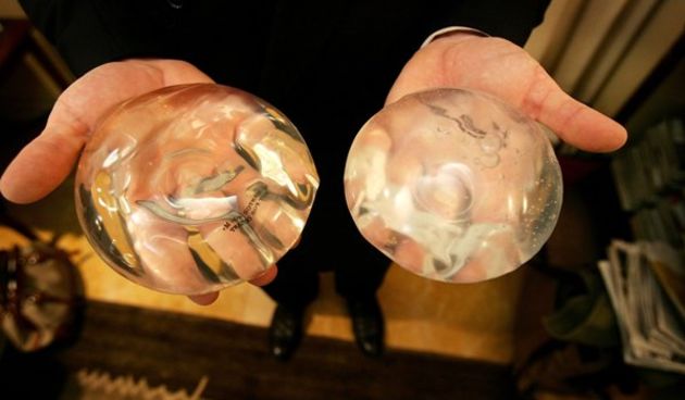 Silikonski implatanti (Metro-portal.hr)