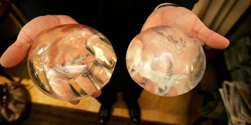 Silikonski implatanti (Metro-portal.hr) Silikonski implatanti (Metro-portal.hr)