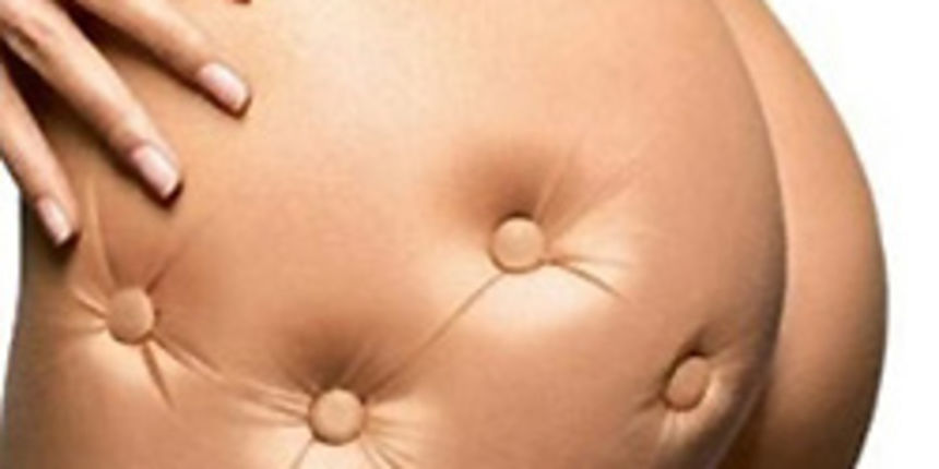 Celulit (Moda.hr) Celulit (Moda.hr)