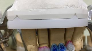 Natjecanje budućih dentalnih tehničara “Schola Medica 2016.” u Medicinskoj školi Ante Kuzmanić