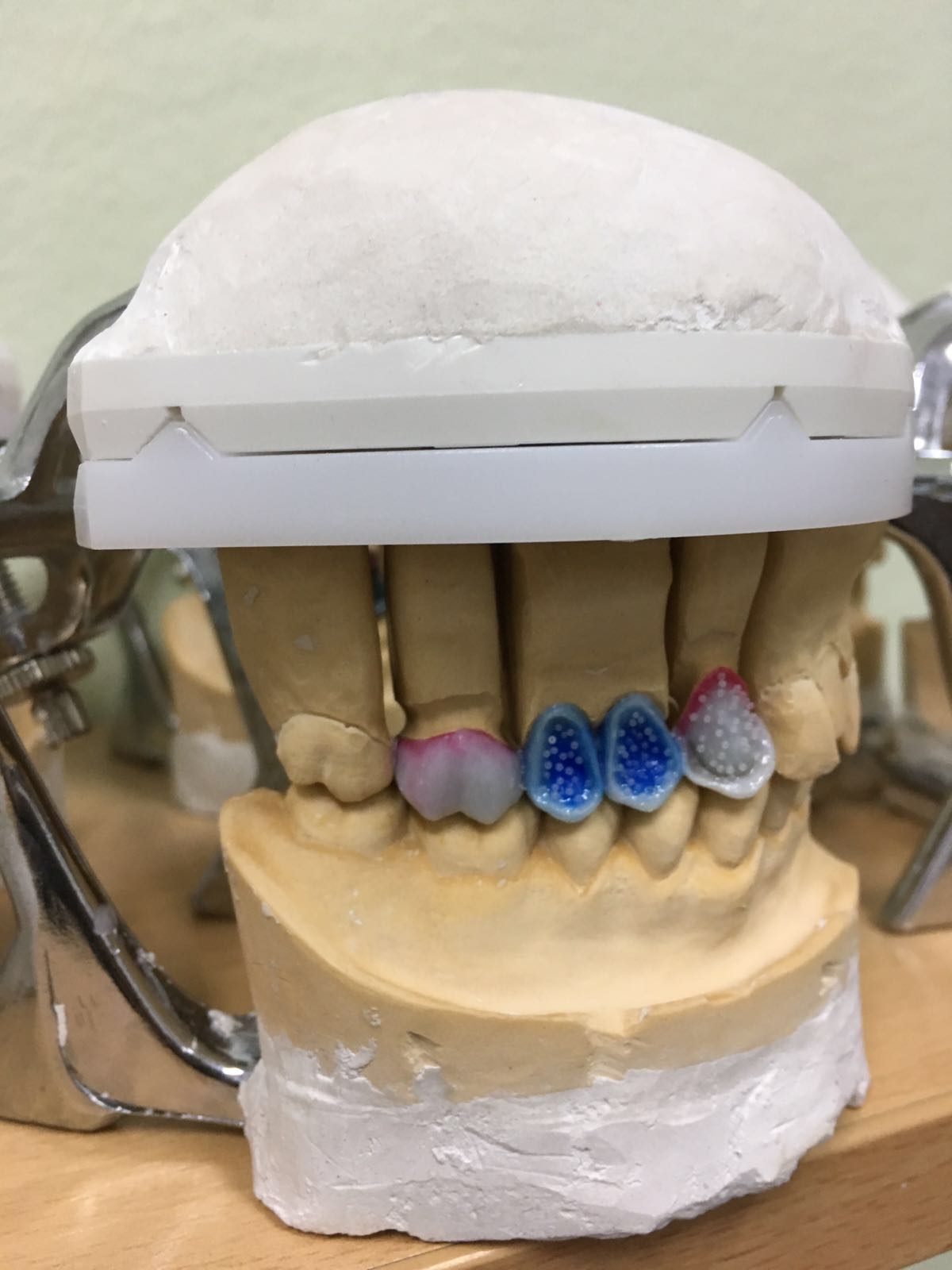 Natjecanje budućih dentalnih tehničara “Schola Medica 2016.” u Medicinskoj školi Ante Kuzmanić