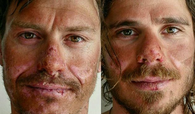 Ivica Kostelić avanturu života završio bolničkim liječenjem