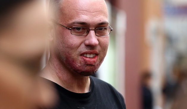 Zadar, 231110.
Zupaniski sud u Zadru.
Pocelo je  sudjenje bivsem sibensko – kninskom zupanijskom vatrogasnom zapovjedniku Drazenu Slavici u slucaju tragedije na Kornatu.
Na fotografiji: Frane Lucic jedini prezivjeli vatrogasac.
Foto: Vladimir Ivanov / CRO