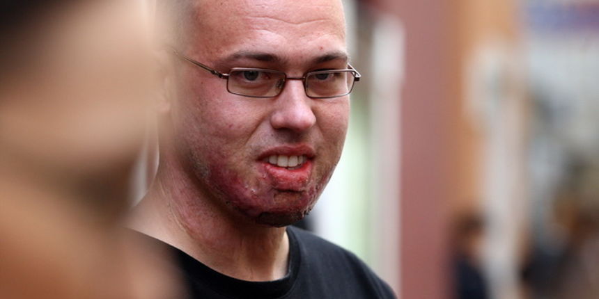 Zadar, 231110.
Zupaniski sud u Zadru.
Pocelo je sudjenje bivsem sibensko – kninskom zupanijskom vatrogasnom zapovjedniku Drazenu Slavici u slucaju tragedije na Kornatu.
Na fotografiji: Frane Lucic jedini prezivjeli vatrogasac.
Foto: Vladimir Ivanov / CRO Zadar, 231110.
Zupaniski sud u Zadru.
Pocelo je sudjenje bivsem sibensko – kninskom zupanijskom vatrogasnom zapovjedniku Drazenu Slavici u slucaju tragedije na Kornatu.
Na fotografiji: Frane Lucic jedini prezivjeli vatrogasac.
Foto: Vladimir Ivanov / CRO