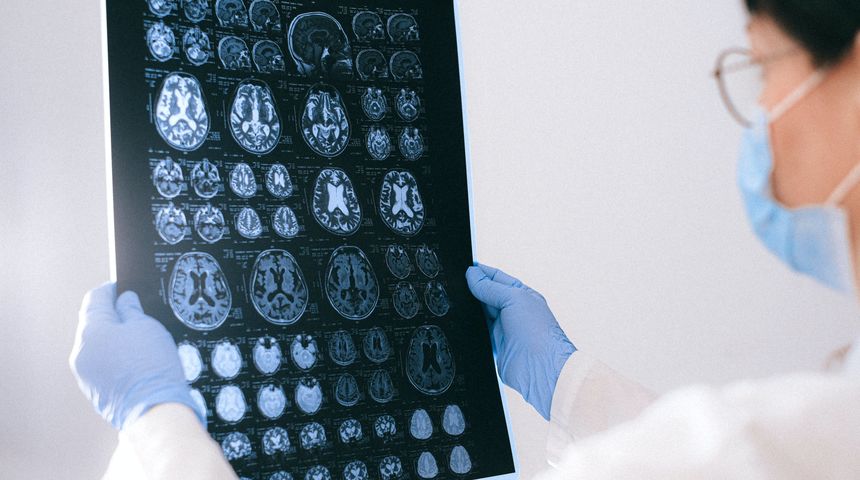 Mozak moždani udar ilustracija