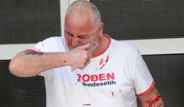 Bivši branitelj se, u bijesu zbog presude, razrezao, foto: CROPIX