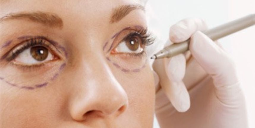 Face lifting, Foto: plasticsurgeryforwomen.net Face lifting, Foto: plasticsurgeryforwomen.net