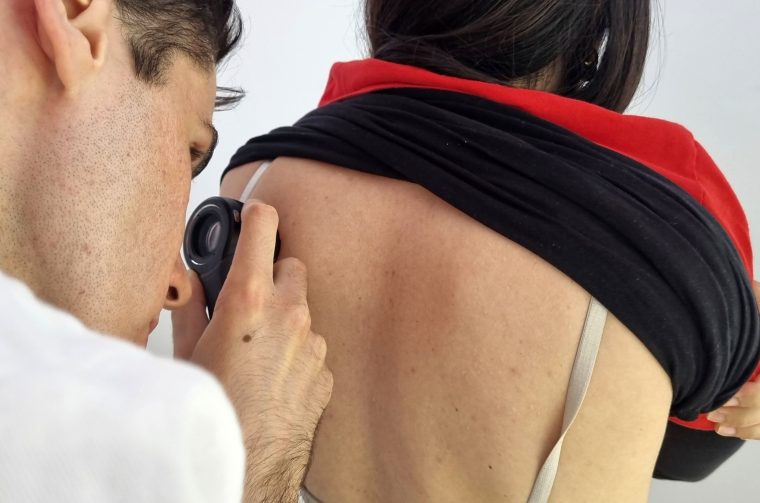 Dermatološki pregled u Zadru (3)