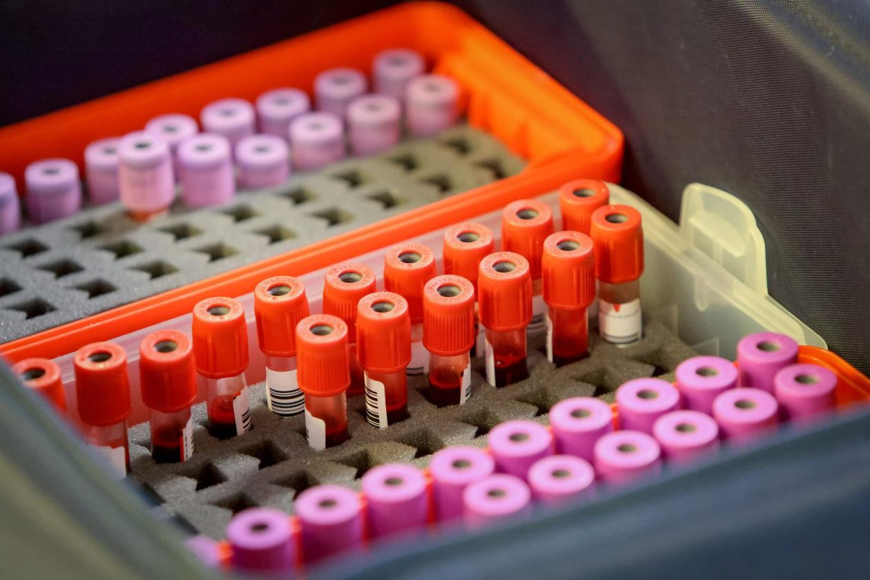 Zadar: Velika humanitarna akcija dobrovoljnog darivanja krvi