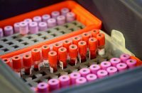 Zadar: Velika humanitarna akcija dobrovoljnog darivanja krvi