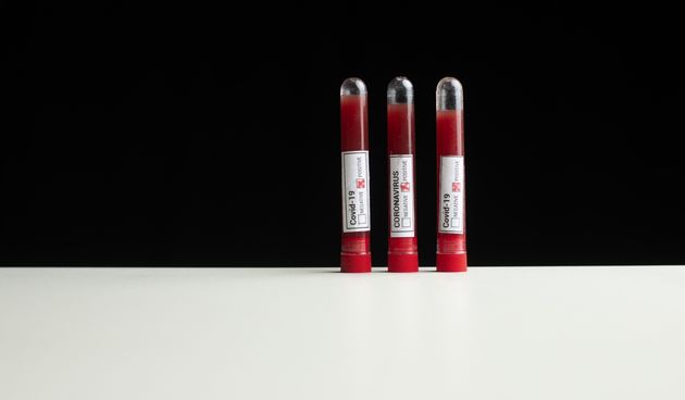 Testiranje na koronavirus