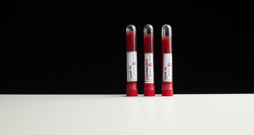 Testiranje na koronavirus