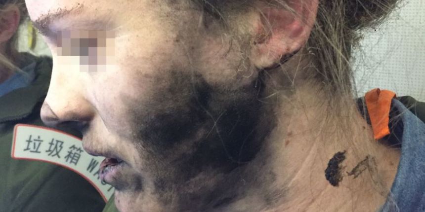 Bežične slušalice eksplodirale u zrakoplovu