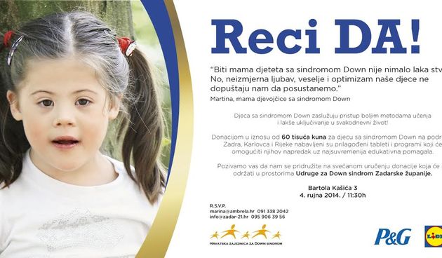 Donacija, Udruga za sindrom Down Zadar