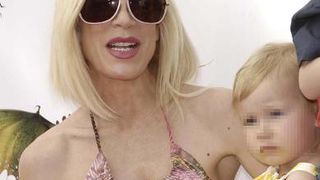 Nezdravo mršave celebrity dame