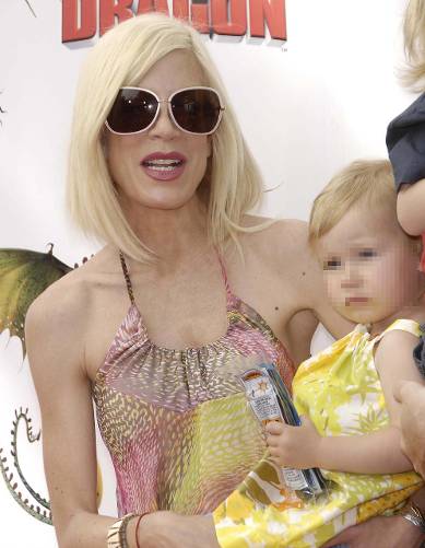 Nezdravo mršave celebrity dame