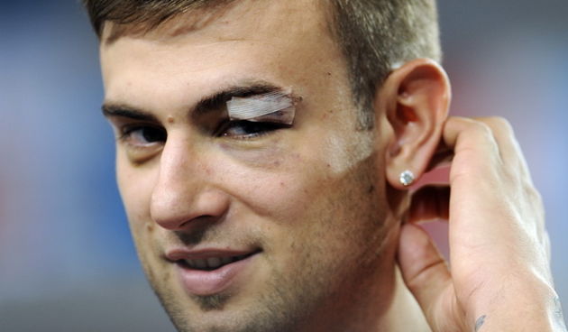 Bydgoszcz, 120909.
Europsko prvenstvo u kosarci u Poljskoj.
Dvorana Sport Arena Luczniczka.
Na slici: Mario Kasun nije trenirao zbog ozljede arkade sa tri dobivena sava nakon udarca ruskog igraca Mozgova.
Foto: Drago Sopta  / CROPIX