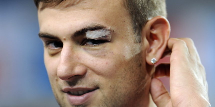 Bydgoszcz, 120909.
Europsko prvenstvo u kosarci u Poljskoj.
Dvorana Sport Arena Luczniczka.
Na slici: Mario Kasun nije trenirao zbog ozljede arkade sa tri dobivena sava nakon udarca ruskog igraca Mozgova.
Foto: Drago Sopta  / CROPIX