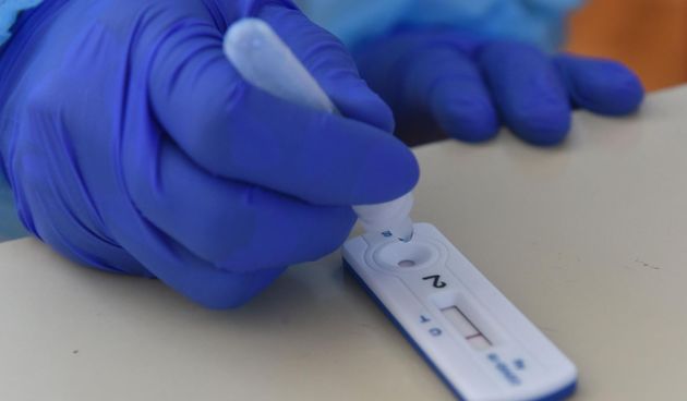 Koronavirus ilustracija, test, antigenski test, testiranje