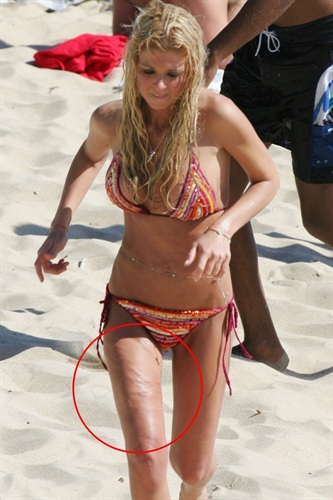 Tara Reid, žrtva plstičnih operacija (Index.hr)