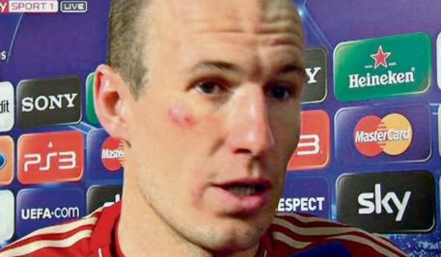 Arjen Robben, screenshot: Sky Sport