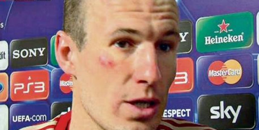 Arjen Robben, screenshot: Sky Sport