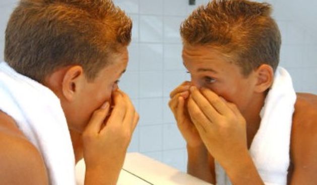 Problemi s prištićima (Foto: Tportal.hr)