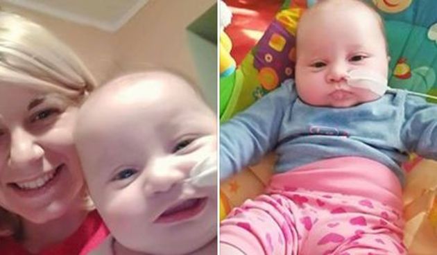 Lorena, prva djevojčica u Europi sa sraslim čeljustima