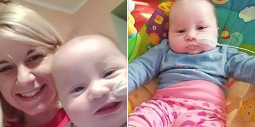 Lorena, prva djevojčica u Europi sa sraslim čeljustima