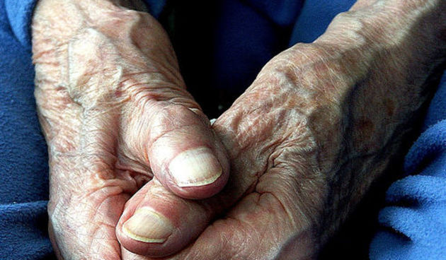 Stare ruke – starost (Foto: flickr.com)